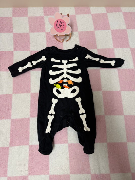 Newborn skeleton sleeper